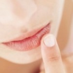 Treating the common cold sore